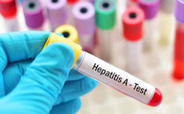 Népegészségügyi központ: dinamikusan emelkedik a hepatitis A-val fertőzöttek száma