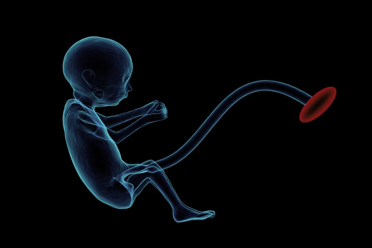 Köldökzsinórvér levétel