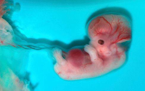 Magzatvédelemért kampányolt a KDNP Salgótarjánban