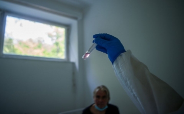 Közösen fejlesztenek koronavírus elleni vakcinát a PTE kutatói egy osztrák céggel
