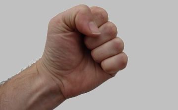 Arcon ütötte, ezért téglával támadt