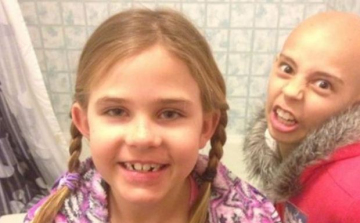 Kitiltották a suliból, mert kiállt rákos barátnője mellett